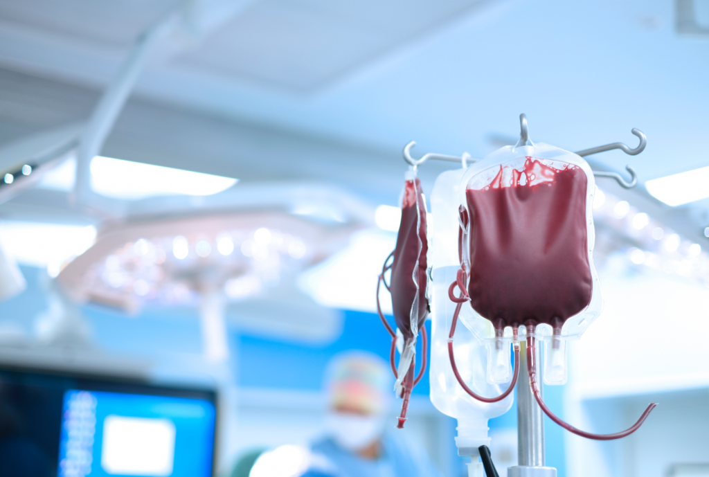 Bolsa de sangue utilizada para transfusão hospitalar em ambiente cirúrgico, com equipo e tubos conectados. Imagem relacionada a doação de sangue, hemoterapia, procedimentos médicos, centro cirúrgico e tratamento de pacientes em estado crítico.